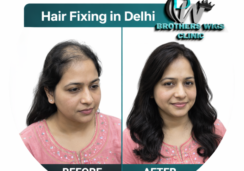 6969ee4a755f0a322b7984d9ladieshairfixingindelhi